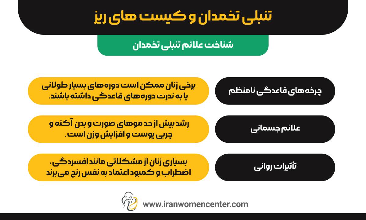 تنبلی تخمدان و کیست های ریز